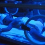 Síntomas de la apnea en bebés prematuros