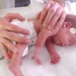 Enfermedades en lo bebés prematuros