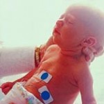 Vacuna de la gripe en los bebés prematuros
