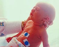 vacunas-en-el-bebe-prematuro